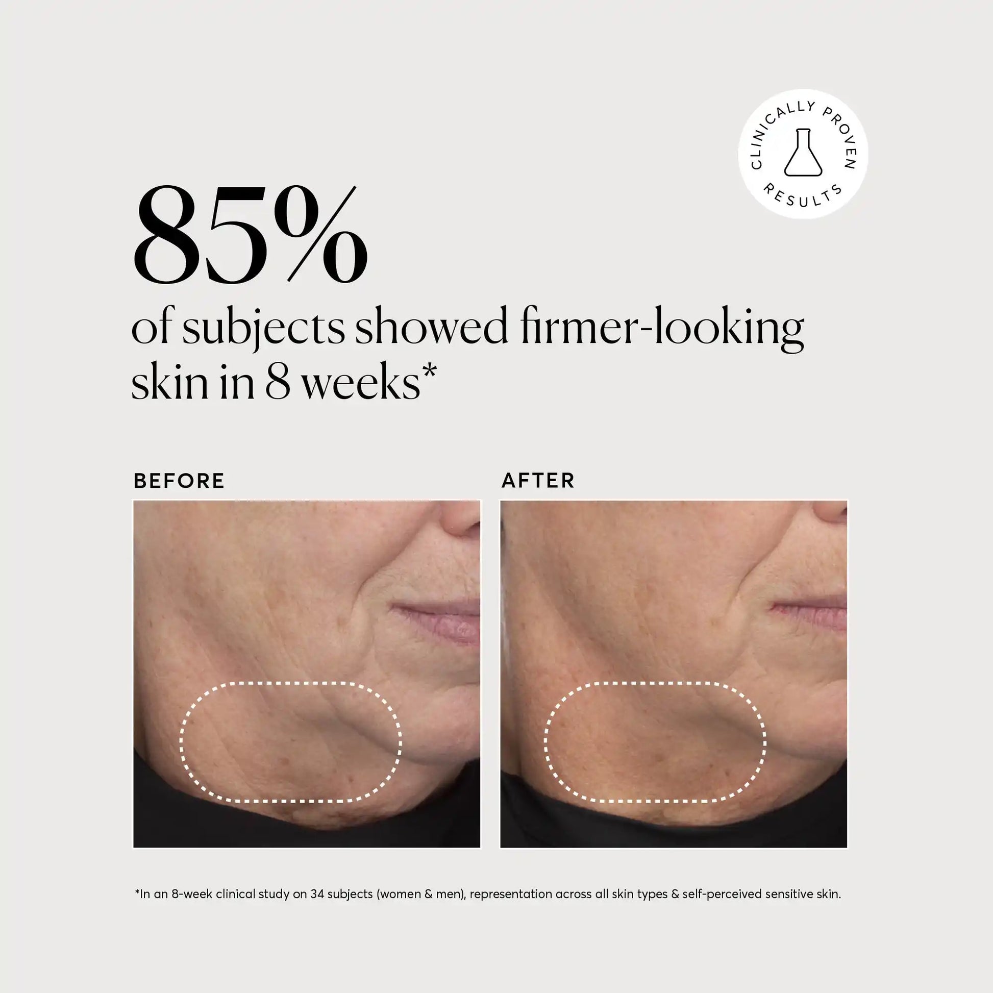 retinol-complex-serum-s1 NATR-10034-Alt-Images-Retinol-Complex-Serum-04.webp